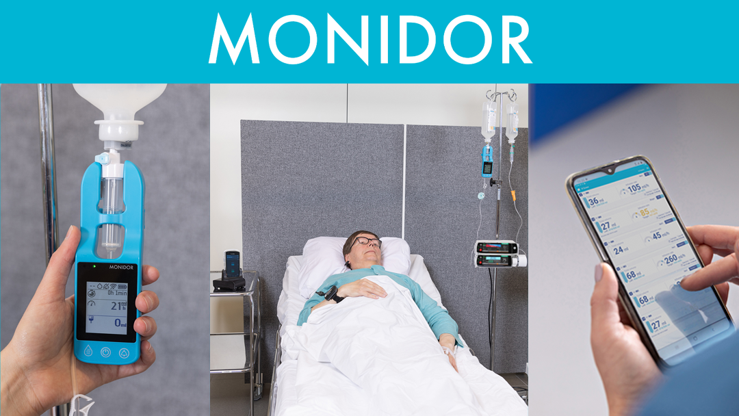 Monidor remote monitoring